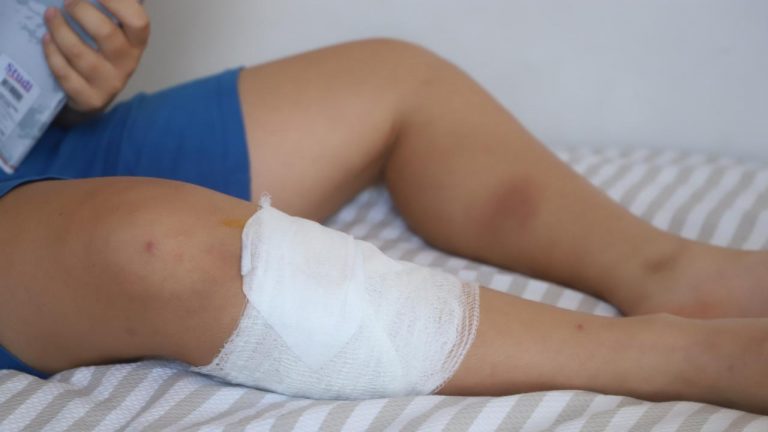 Ankara’da sokak köpeklerinin saldırısına uğrayan bir çocuk yaralandı