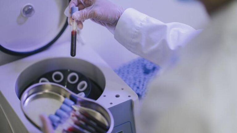 PRP tedavisi nedir, nasıl yapılır? PRP tedavisi çalışıyor mu?